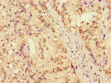 ZRANB3 Antibody