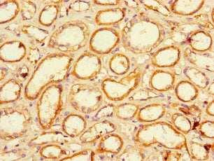 LACTB2 Antibody