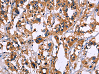 ZEB2 Antibody