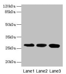 KHDC1 Antibody