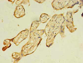 FNDC3B Antibody