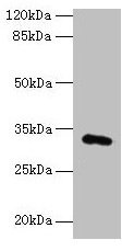 FAM78A Antibody