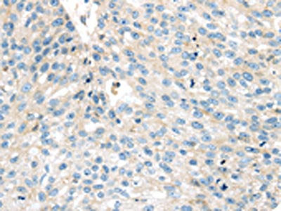 VPS26A Antibody