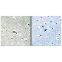 FLT1 Antibody