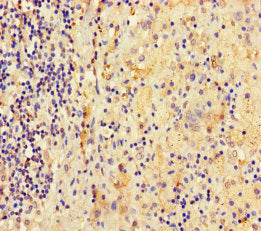 ATAD3C Antibody