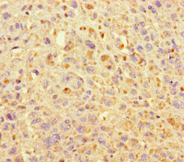 KIF24 Antibody