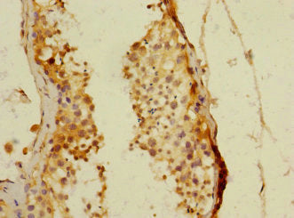 PDE4DIP Antibody