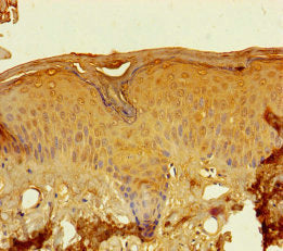 LCE2A Antibody
