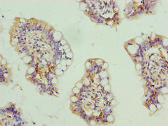 SCARA3 Antibody