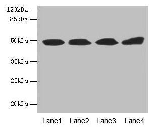 TBCEL Antibody