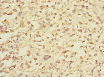 DDX59 Antibody