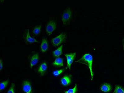 ZDHHC20 Antibody