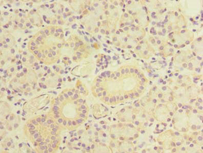 TBC1D9B Antibody