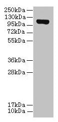 DENND2C Antibody
