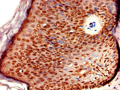 ERVK-6 Antibody