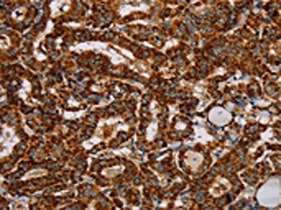 NDUFS3 Antibody