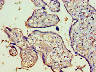 FAM160B1 Antibody