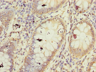 FBXW10 Antibody