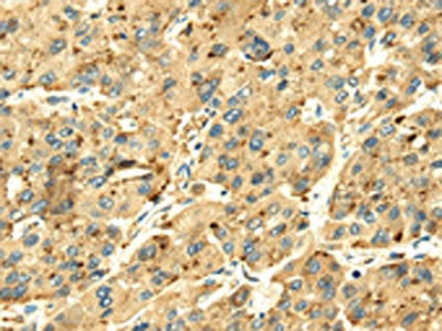 SENP2 Antibody