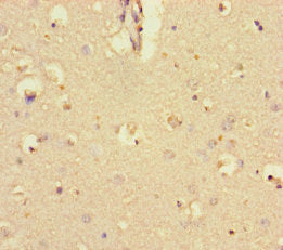 KCTD16 Antibody