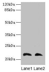 LGALS9C Antibody