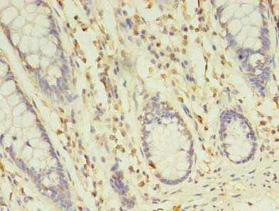 TREML2 Antibody