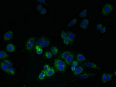 LDLRAD1 Antibody