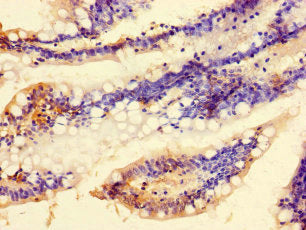 C9orf57 Antibody