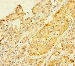 ZKSCAN2 Antibody