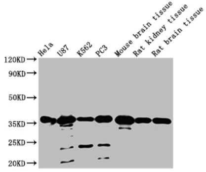 METRNL Antibody