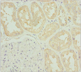 TNS3 Antibody