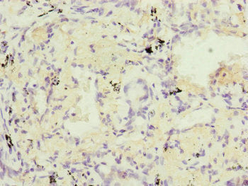 RARS2 Antibody
