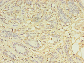 AGBL2 Antibody
