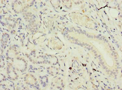 SUSD4 Antibody