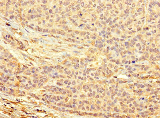 METTL21C Antibody