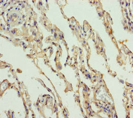 SLC34A1 Antibody