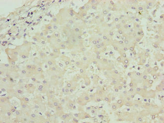 RPL7L1 Antibody