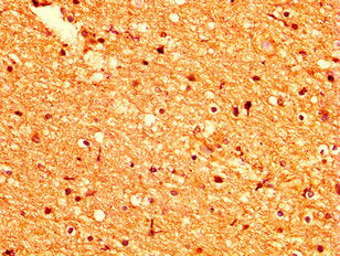 GPR158 Antibody