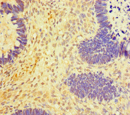 RNF20 Antibody