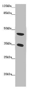 TENT5C Antibody