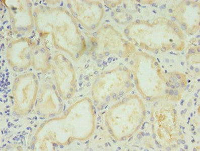 LYPLAL1 Antibody