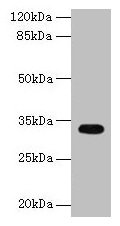 CYB5R2 Antibody