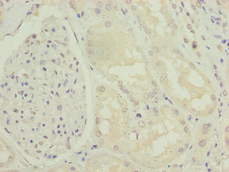 ENPP6 Antibody