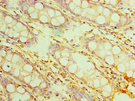 IL20RB Antibody
