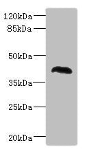 NHLRC1 Antibody