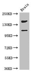 PREX2 Antibody