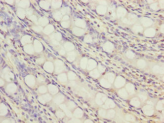 ZNF767P Antibody