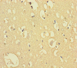 CXXC5 Antibody