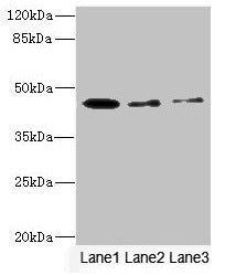 SIGIRR Antibody