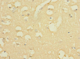 GALNT17 Antibody